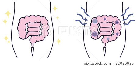 腸道活動腸道簡單圖解 腸道活動腸道簡單圖解 82089086