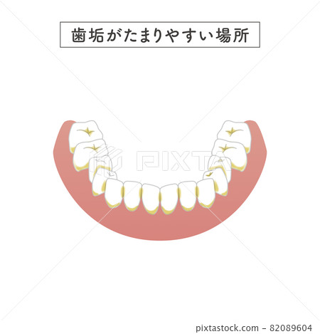 Illustration of a place that is easy to leave unpolished Illustration of a place that is easy to leave unpolished 82089604