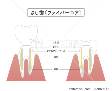 Structural illustration of cutting teeth 82089616
