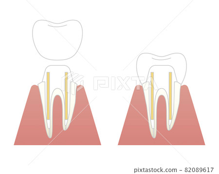 Structural illustration of cutting teeth 82089617