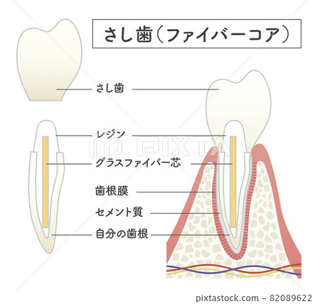 Structural illustration of cutting teeth 82089622