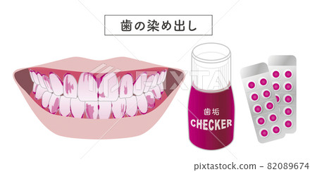 Tooth dyeing set illustration Tooth dyeing set illustration 82089674