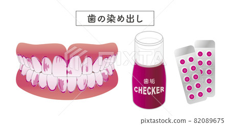 Dental plaque dyeing set illustration Dental plaque dyeing set illustration 82089675