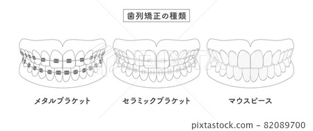 Orthodontic type set illustration 82089700