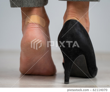 A woman in black shoes puts a plaster on a corn 82114070