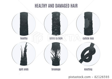 Big set of magnified follicles showing types of hair damage 82126593