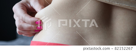 Woman shows excess fat on her sides 82152267