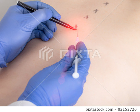 The doctor injects the patient with an anti-inflammatory drug at the trigger points. Treatment of muscle back pain, chondroprotector 82152726