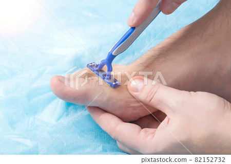 A man holds a razor near his toes where hair grows. Concept for shaving hair on legs and toes, epilation, cosmetic A man holds a razor near his toes where hair grows. Concept for shaving hair on legs and toes, epilation, cosmetic 82152732