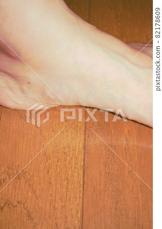 Arch of the foot, female Arch of the foot, female 82178609