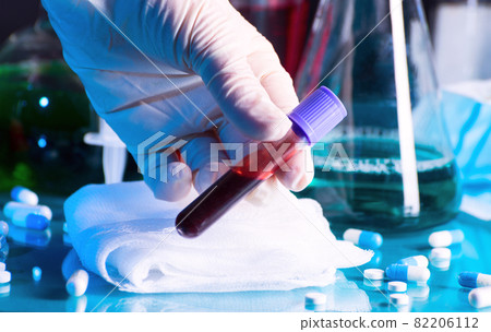 Coronavirus 2019-nCoV concept still life with blood test, drugs and laboratory flasks. COVID-19 background. 82206112