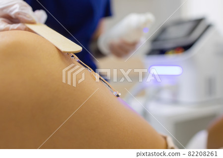 Beautician Giving Epilation Laser Treatment To Woman On Thigh. Beautician Giving Epilation Laser Treatment To Woman On Thigh. 82208261