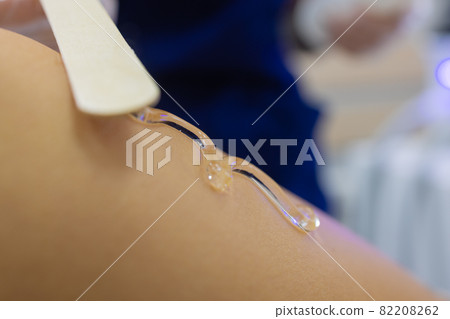 Beautician Giving Epilation Laser Treatment To Woman On Thigh. 82208262