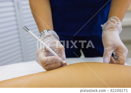 Beautician Giving Epilation Laser Treatment To Woman On Thigh. 82208271