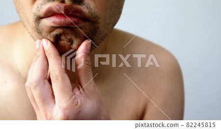 患有硬毛鬍子的日本人 82245815