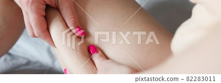Woman holding with her hands skin fold with cellulite on her thigh closeup Woman holding with her hands skin fold with cellulite on her thigh closeup 82283011