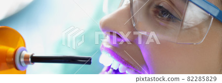 Doctor dentist shining on teeth of female patient curing light closeup 82285829