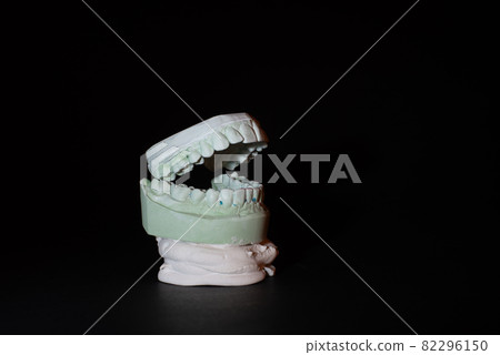 Gypsum Dental model of human teeth on black background. 82296150