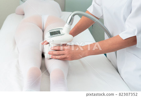 Woman in special white suit getting anti cellulite massage for legs in a spa salon. LPG, and body contouring treatment in clinic. 82307352