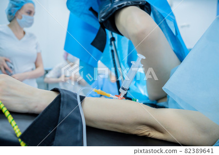 Hand and foot of the patient. A catheter with an anesthesia syringe is inserted into the arm.  82389641