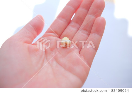 Wisdom tooth extraction 82409034