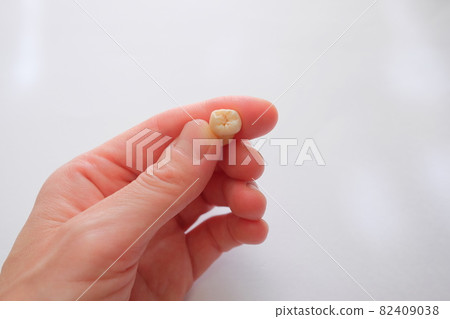 Wisdom tooth extraction Wisdom tooth extraction 82409038