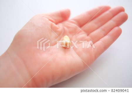 Wisdom tooth extraction Wisdom tooth extraction 82409041