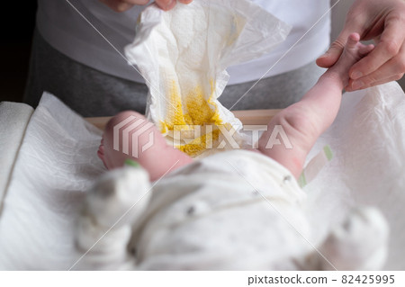 Father changing dirty stinky diaper with yellow poop for his newborn baby 82425995