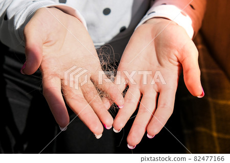 Female hand holding lost hair. Alopecia hair loss treatment concept, hair fall everyday serious problem. Solutions Female hand holding lost hair. Alopecia hair loss treatment concept, hair fall everyday serious problem. Solutions 82477166