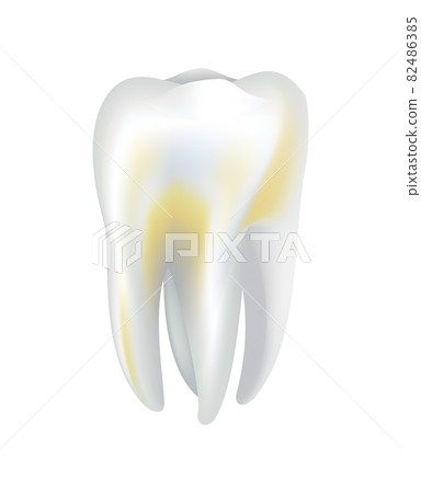 Illnessed human tooth. Dental medical vector icon. Need dental care for stained teeth or tooth caries. Oral teeth restoration Illnessed human tooth. Dental medical vector icon. Need dental care for stained teeth or tooth caries. Oral teeth restoration 82486385