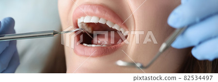 Dentist examines oral cavity of woman patient 82534497