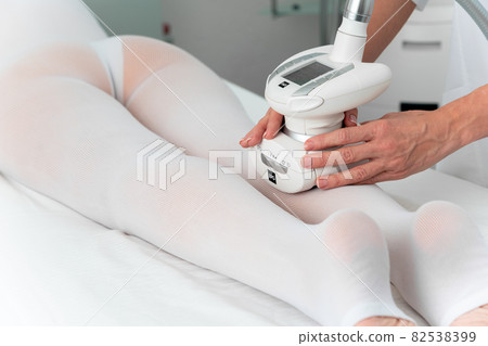 Woman in special white suit getting anti cellulite massage for legs in a spa salon. LPG, and body contouring treatment in clinic. 82538399