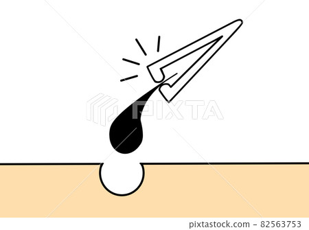 tweezers tweezers 82563753