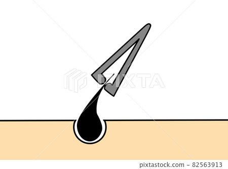 鑷子 鑷子 82563913