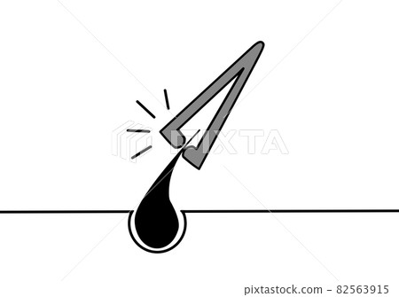 鑷子 鑷子 82563915