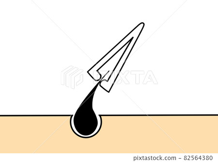 鑷子 鑷子 82564380