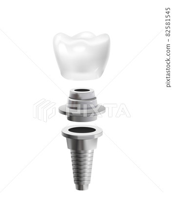 Dental Post Icon 82581545