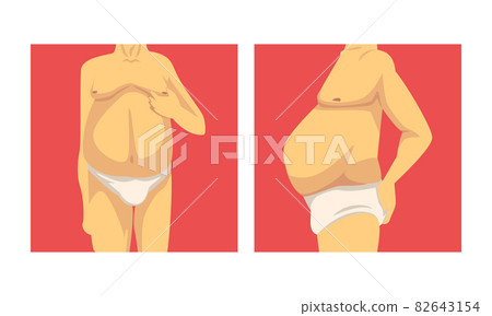 Male Torso with Sagging Belly and Soft Muscles Vector Set Male Torso with Sagging Belly and Soft Muscles Vector Set 82643154