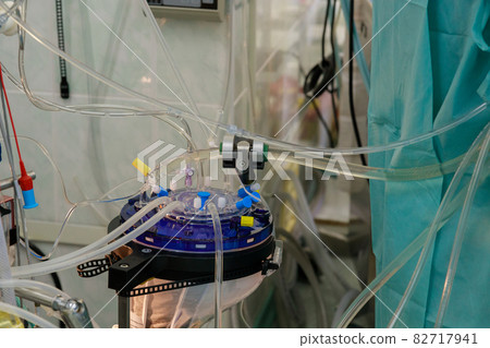 Apparatus circulation blood heart lung machine for heart surgery in operating room Apparatus circulation blood heart lung machine for heart surgery in operating room 82717941