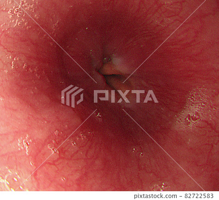 Gastroscope 82722583