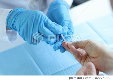 Doctor wearing disposable gloves takes blood from patient finger 82773029