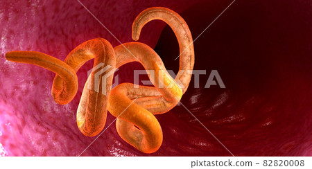 Single twisted nematode inside intestine on a black background - 3d illustration Single twisted nematode inside intestine on a black background - 3d illustration 82820008