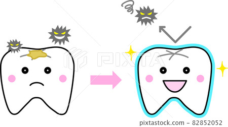 Fluorine application to prevent tooth decay Fluorine application to prevent tooth decay 82852052