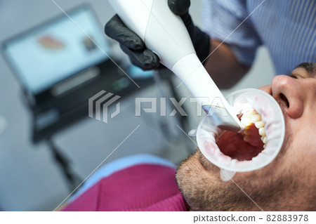 Young man having dental laser treatment at clinic 82883978