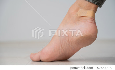 A woman seals a corn on her leg with a plaster. The girl rubbed her leg with uncomfortable shoes. A woman seals a corn on her leg with a plaster. The girl rubbed her leg with uncomfortable shoes. 82884820
