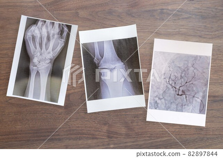 Hand (wrist), knee, heart X-ray CT image Health check 82897844