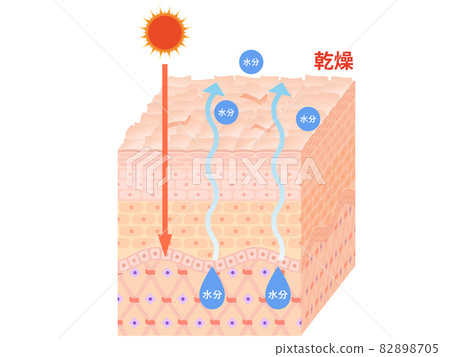 Skin cross section (dry skin) 82898705