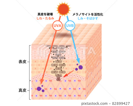 皮膚橫截面（印跡） 82899427