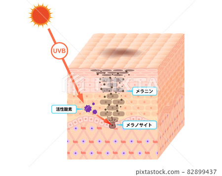Skin cross section (blot) 82899437