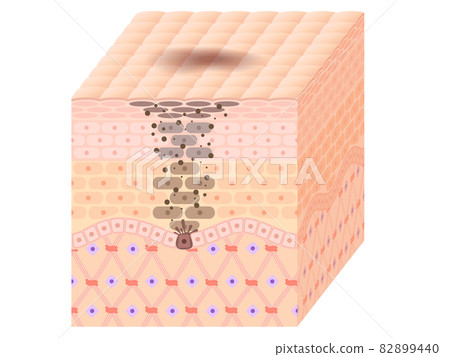Skin cross section (blot) Skin cross section (blot) 82899440